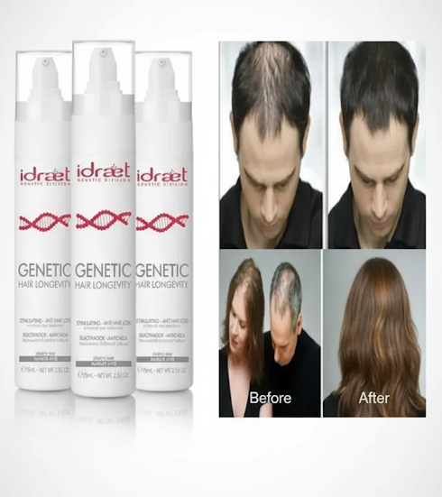 Idraet Locion Caida Cabello Genetic Hair X 3